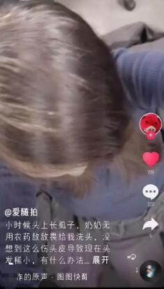 大妈模仿小视频用敌敌畏洗头灭跳蚤 被送医住进ICU