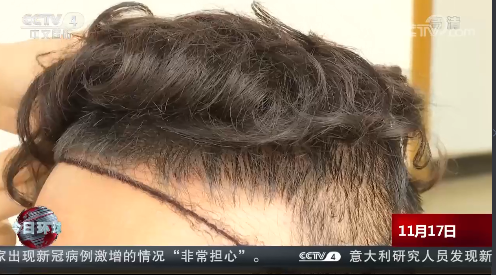 用什么方法可以不掉头发 e2fc9409-cb3a-4c72-9e08-7ca991ece82c.png