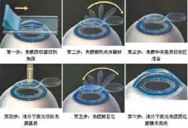 4f1dce96-ac7a-4293-8dc3-2dc02c3401d6.jpg